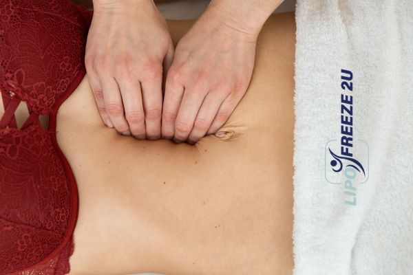 diastasis recti treatment Fareham