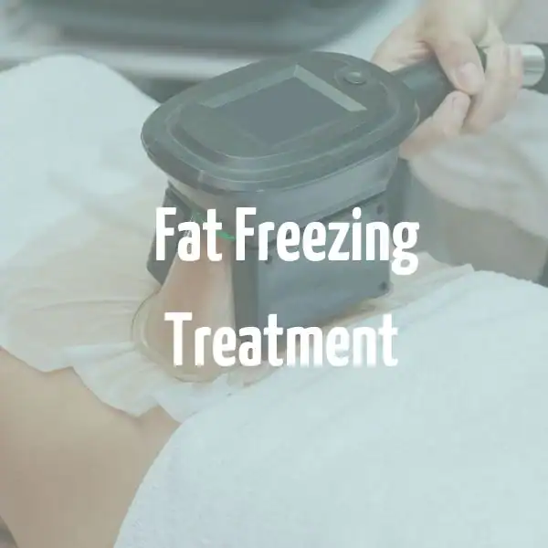 fat freezing treatment Fareham
