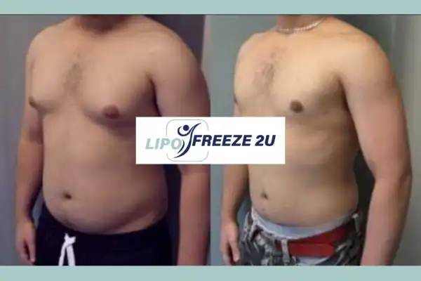 How Long Does It Take to See Results Fareham?
