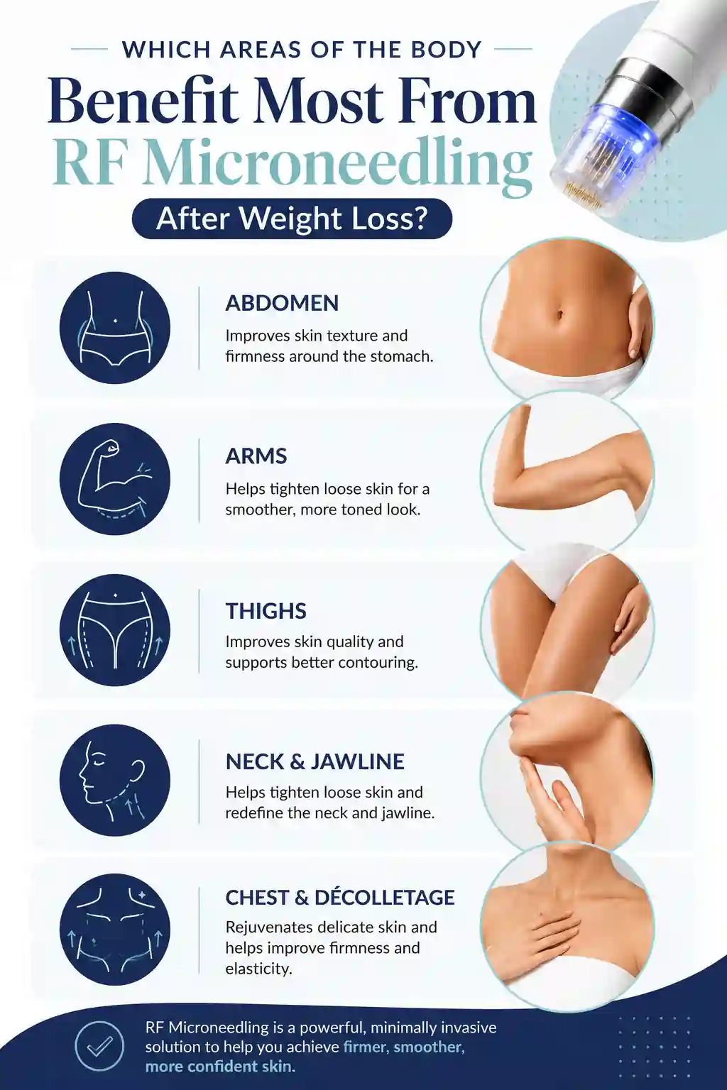 Which Areas of the Body Benefit Most From RF Microneedling After Weight Loss Fareham